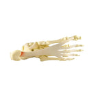 Plantar fasciitis model – fod/ankel