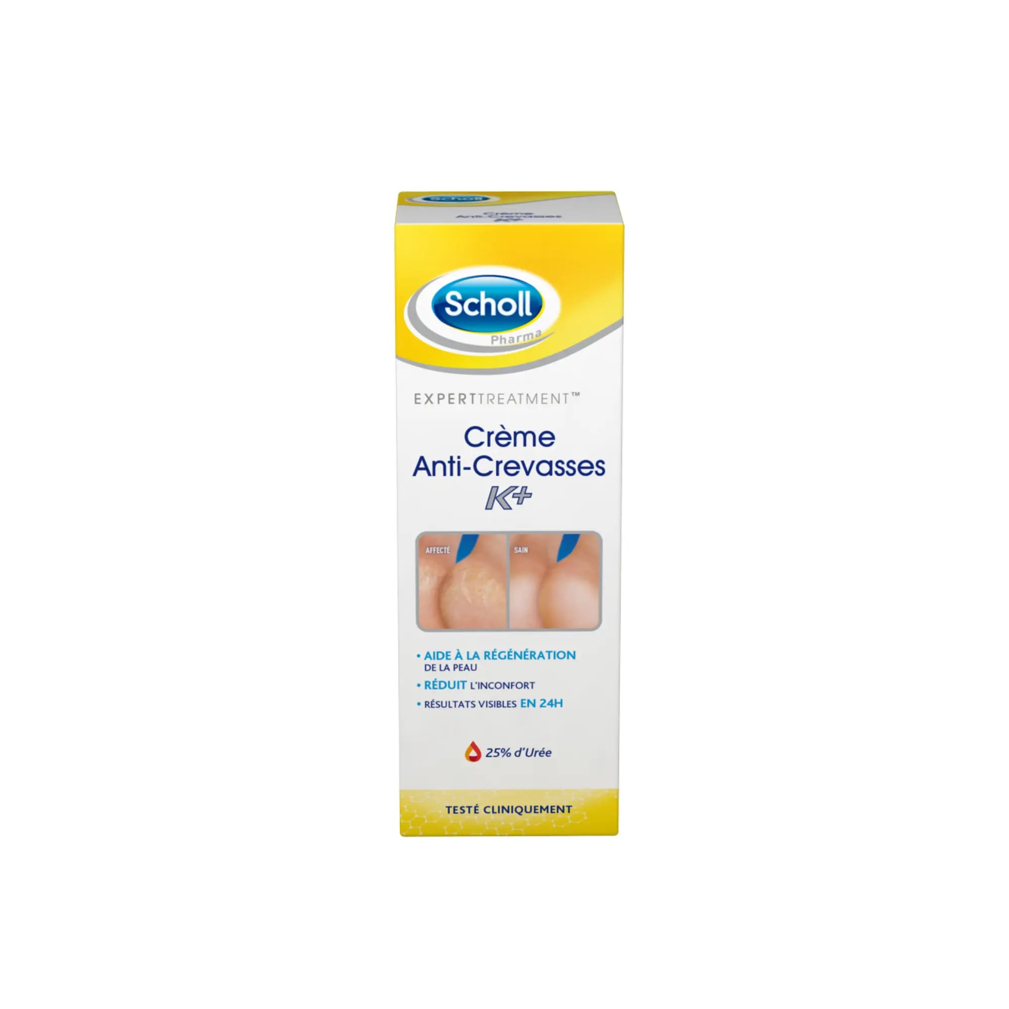 Crème Anti-Crevasses K+ Urée 25% - 2 contenances - Scholl Scholl  60 ml