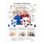 Anatomisk tavle - Alzheimers sygdom - Anatomi og patologi