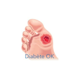 Pedicure Podorape - Fin og medium korn - 16 farver tilgængelige - 27 cm Podorape 