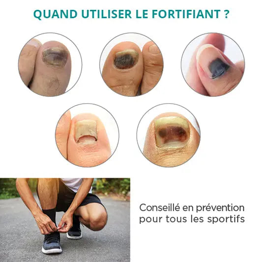 Traitement Sérum Ongles noirs, traumatisés - 8ml - Fortifiant - Poderm Professional - My Podologie